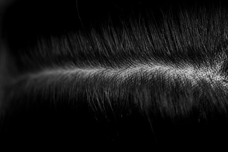 Hair Restoration